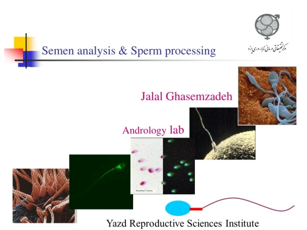 Semen analysis &amp; Sperm processing
