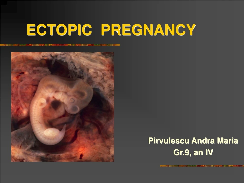 ectopic pregnancy