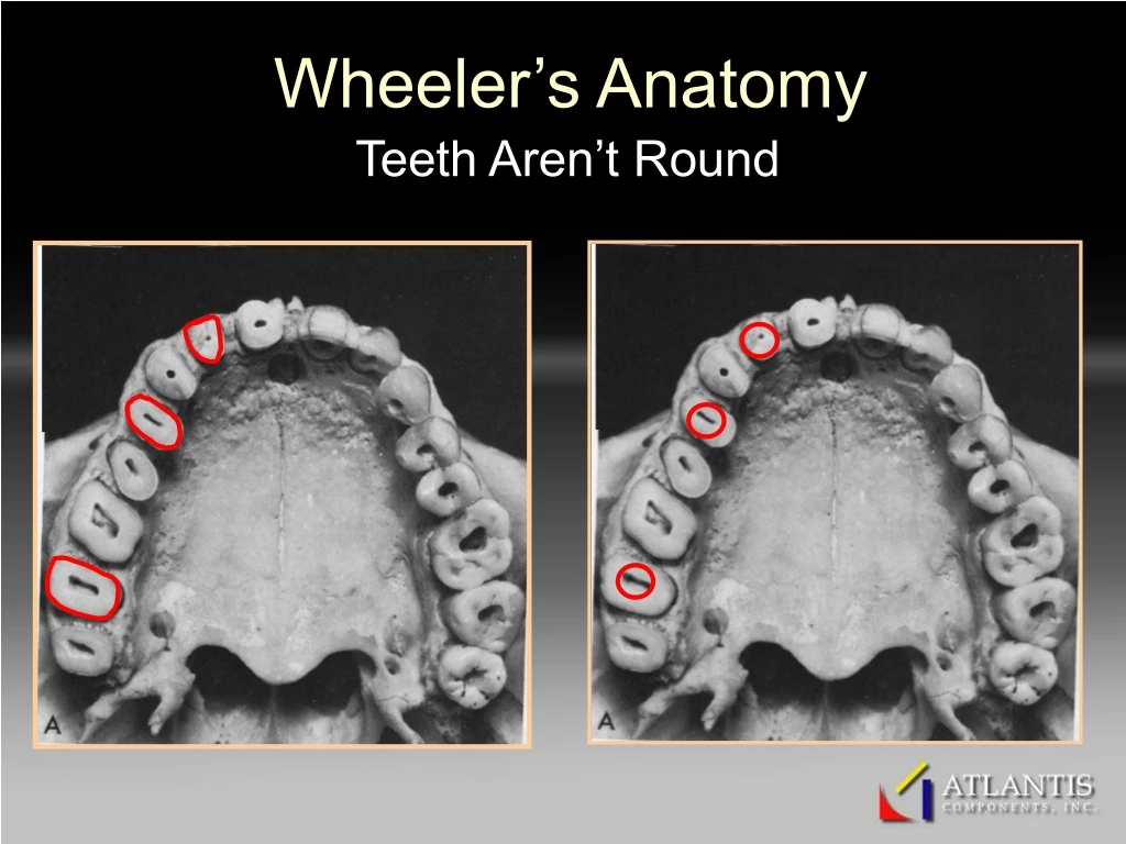 wheeler s anatomy