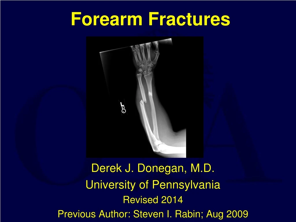 PPT Forearm Fractures PowerPoint Presentation Free Download ID 9180270