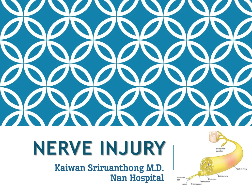 nerve injury