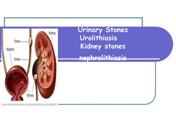 Urinary Stones        Urolithiasis           Kidney stones           nephrolithiasis