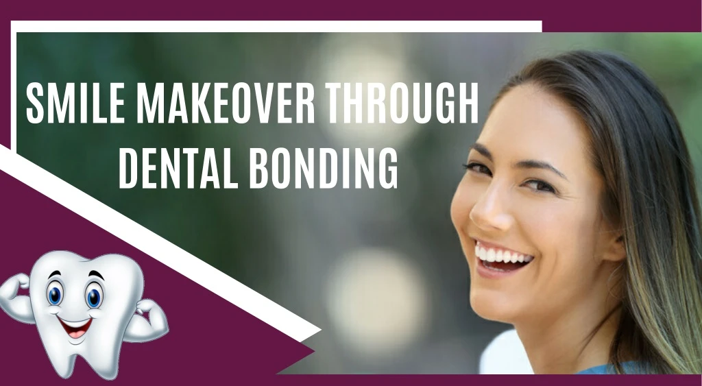 smile makeover through dental bonding