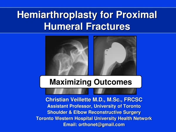 Hemiarthroplasty  for Proximal Humeral Fractures