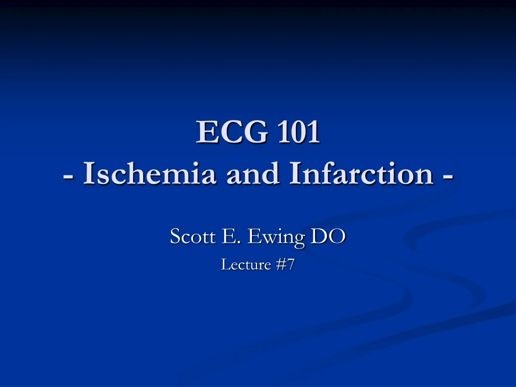 ecg 101 ischemia and infarction