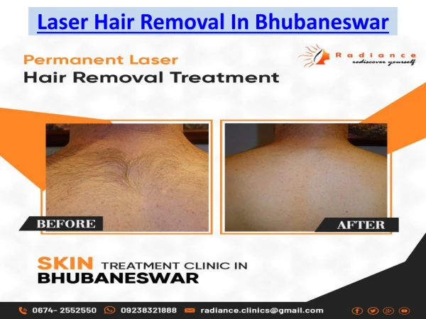 laser hair removal in bhubaneswar