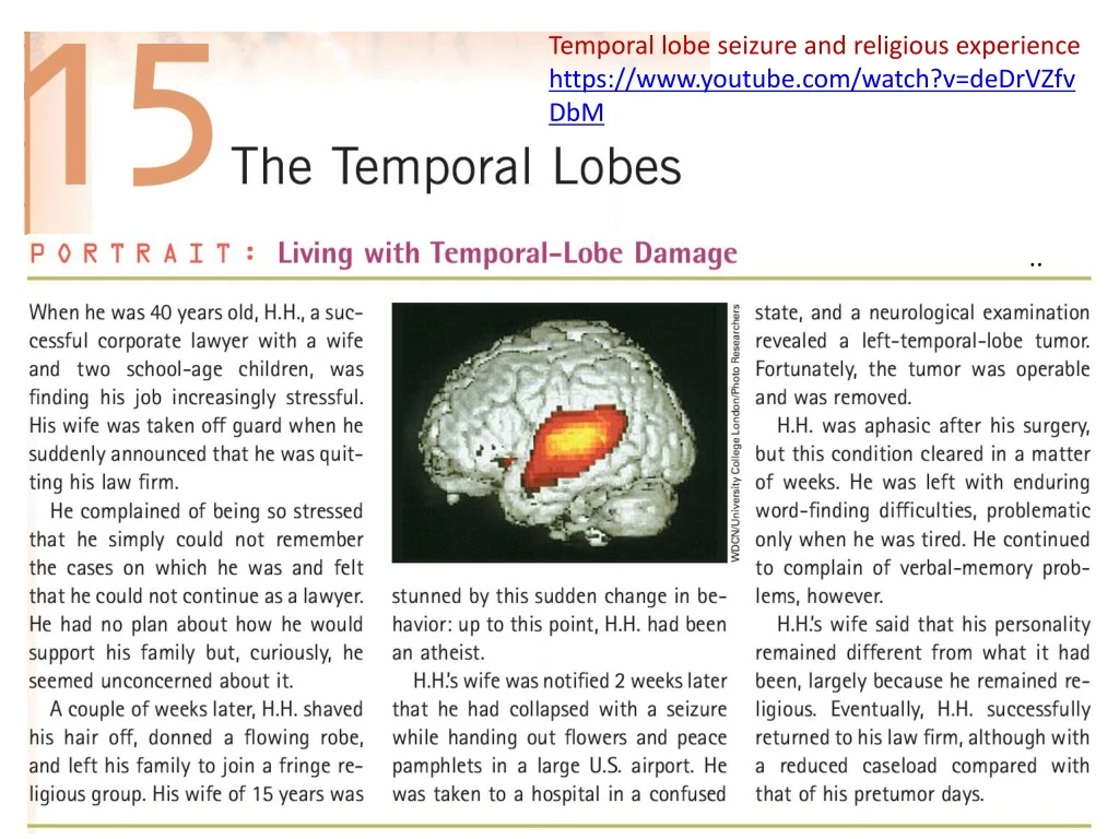 temporal lobe seizure and religious experience