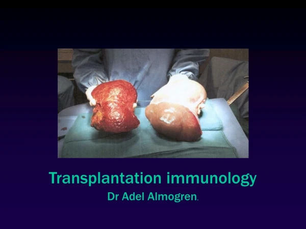 Transplantation immunology Dr Adel Almogren .