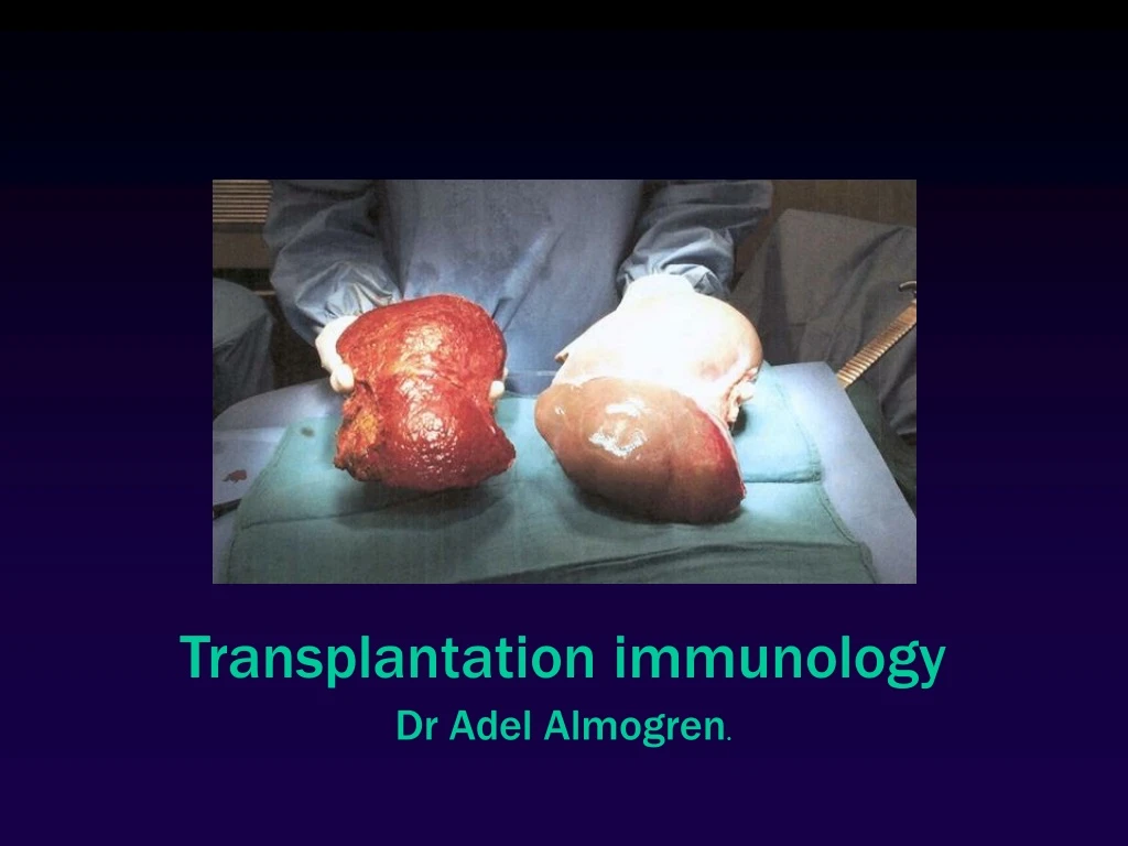 transplantation immunology dr adel almogren