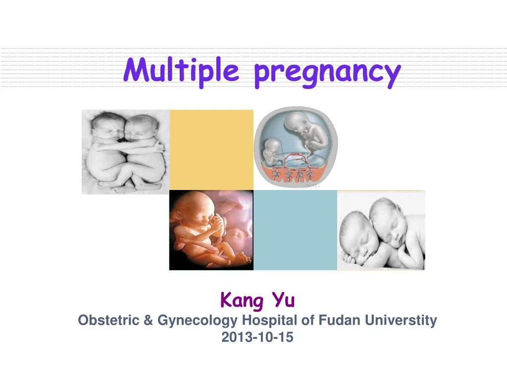 multiple pregnancy