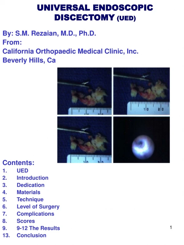 UNIVERSAL ENDOSCOPIC DISCECTOMY  (UED)