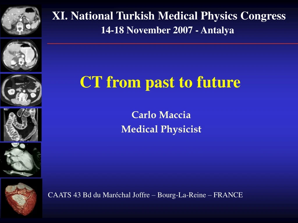xi national turkish medical physics congress