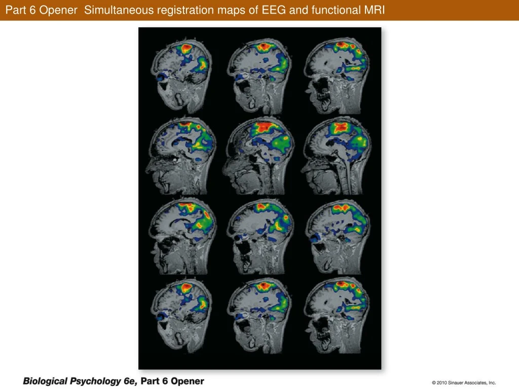 part 6 opener simultaneous registration maps of eeg and functional mri