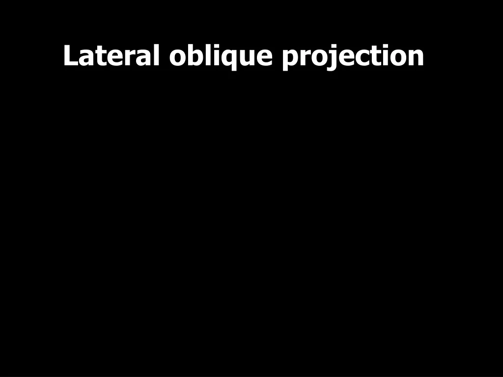 lateral oblique projection