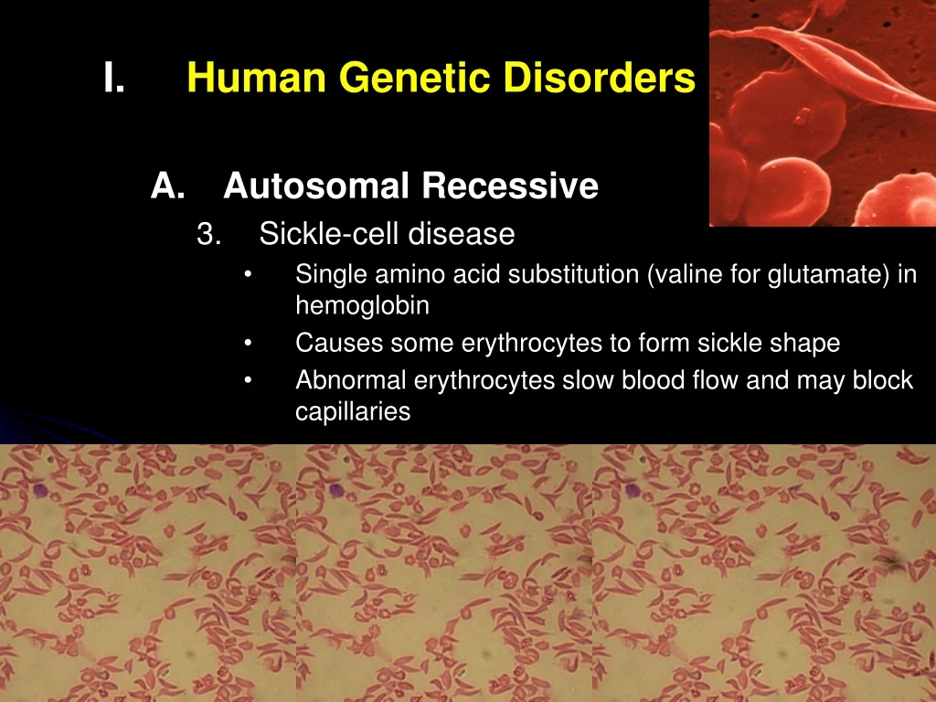 human genetic disorders autosomal recessive