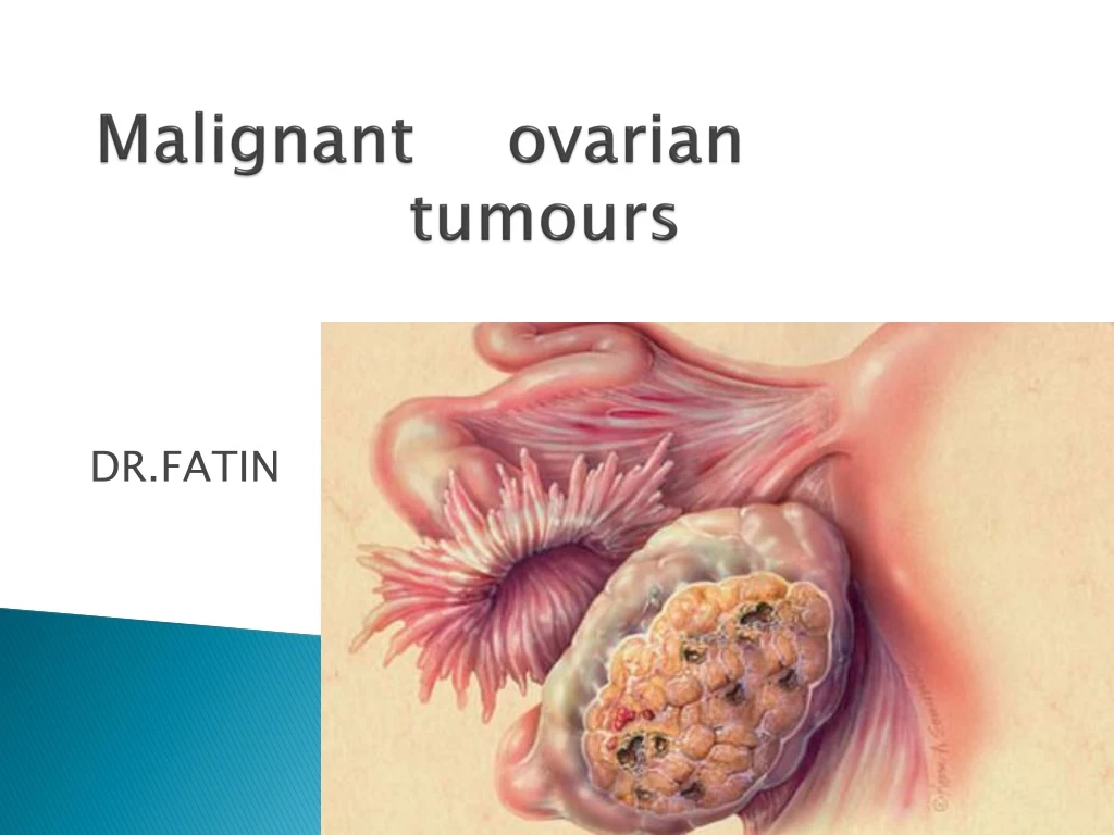 malignant ovarian tumours