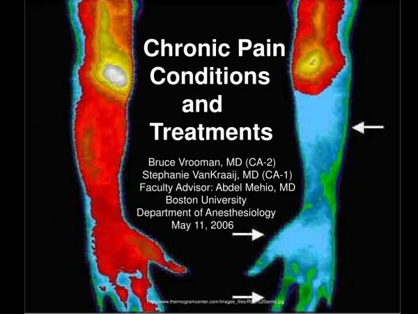 Chronic Pain    Conditions         and    Treatments