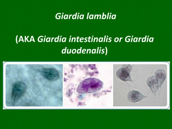 Giardia lamblia (AKA  Giardia intestinalis or Giardia duodenalis )