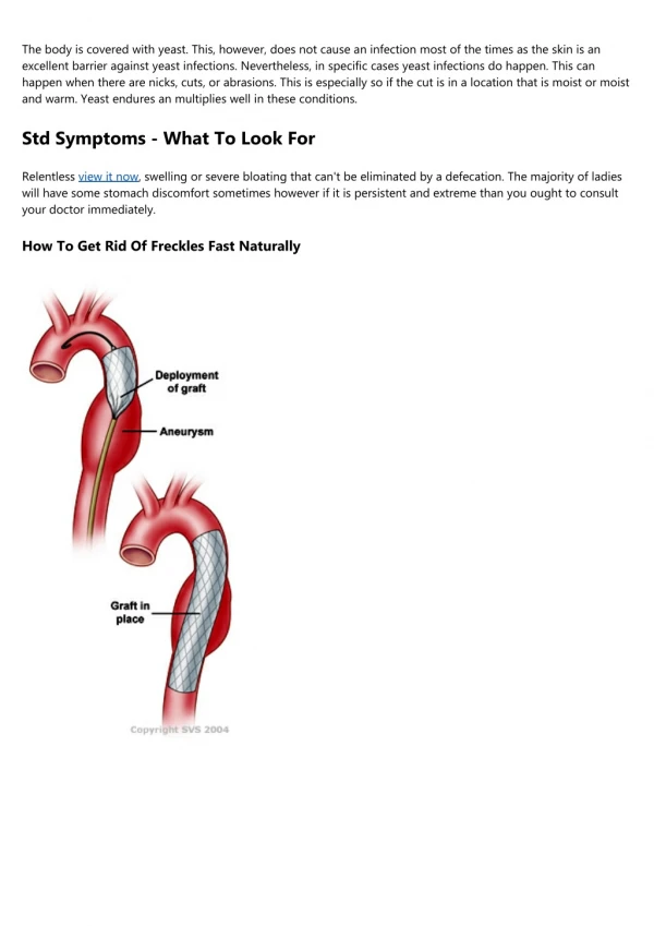 Back Pain - 7 Possibly Deadly Causes