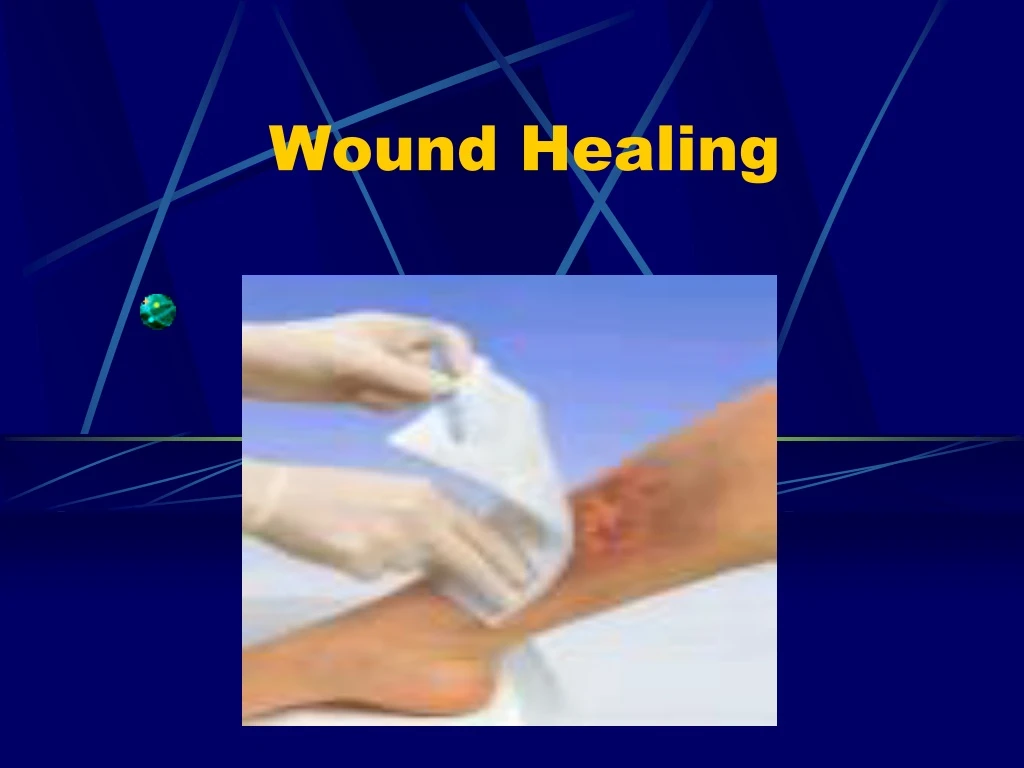 PPT - Wound Healing PowerPoint Presentation, Free Download - ID:9202402