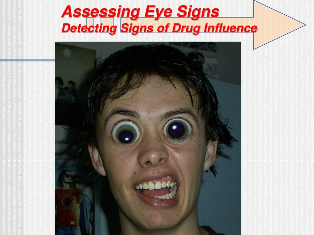 assessing eye signs detecting signs of drug