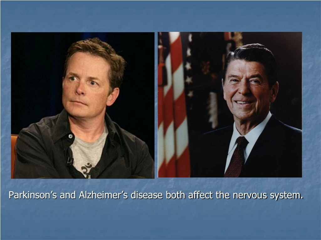 parkinson s and alzheimer s disease both affect