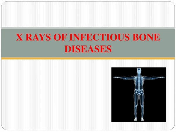 X RAYS OF INFECTIOUS BONE DISEASES