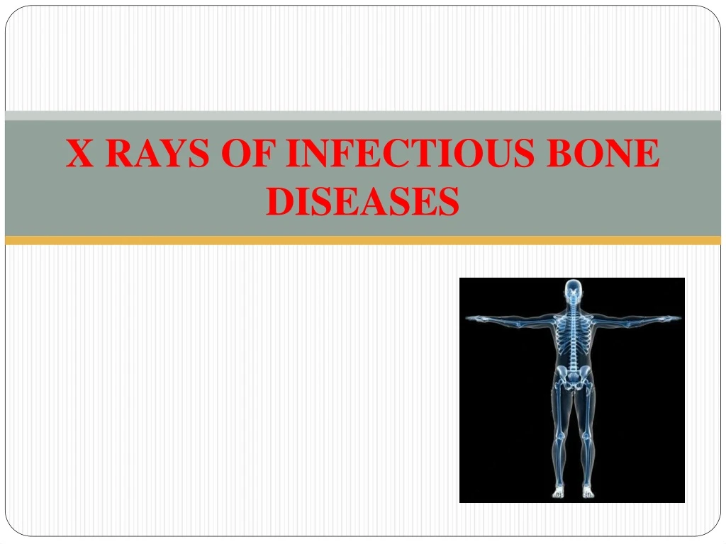 x rays of infectious bone diseases