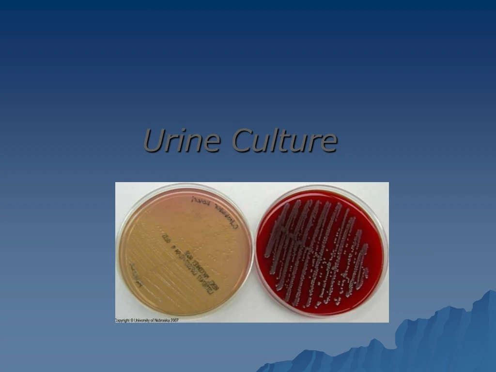 urine culture