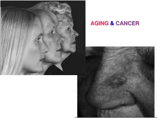 AGING  &amp;  CANCER