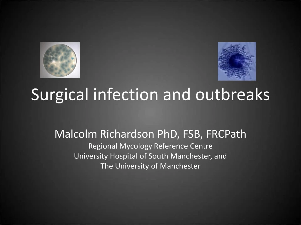 surgical infection and outbreaks