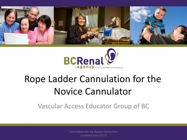 Rope Ladder Cannulation for the Novice Cannulator