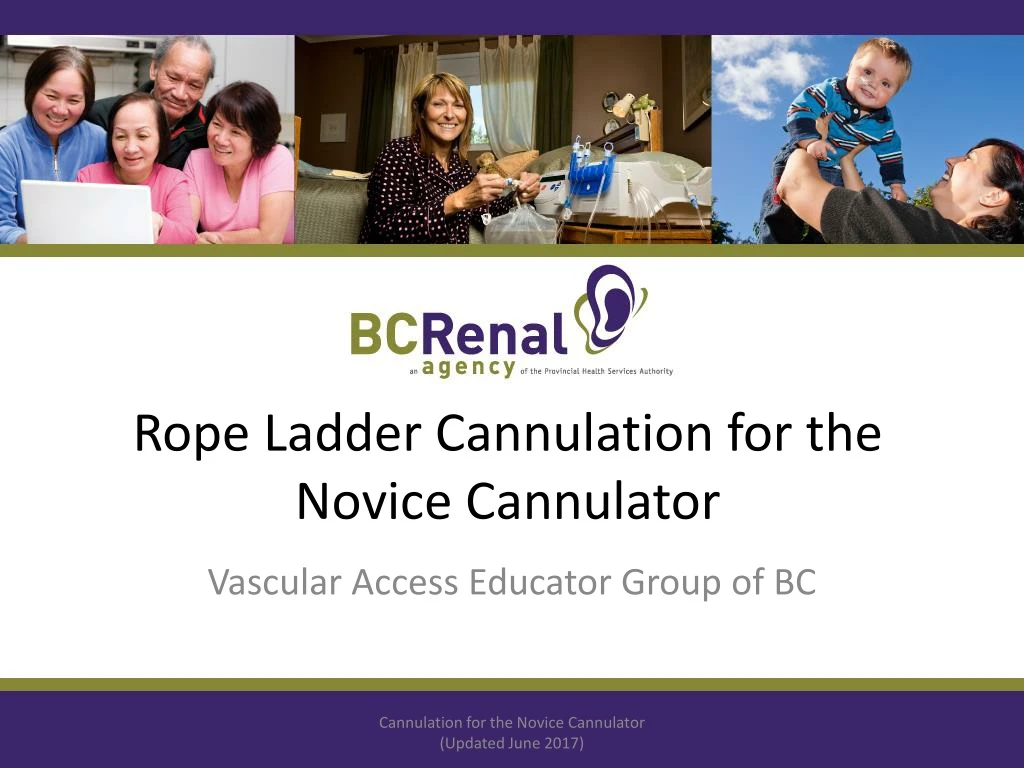 rope ladder cannulation for the novice cannulator