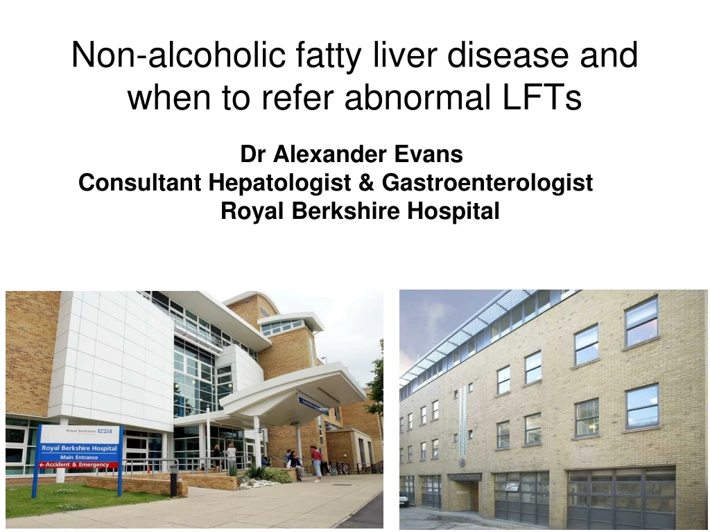 non alcoholic fatty liver disease and when to refer abnormal lfts