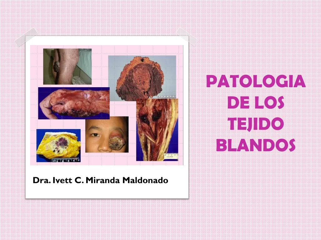 patologia de los tejido blandos