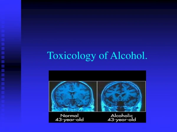 Toxicology of Alcohol.