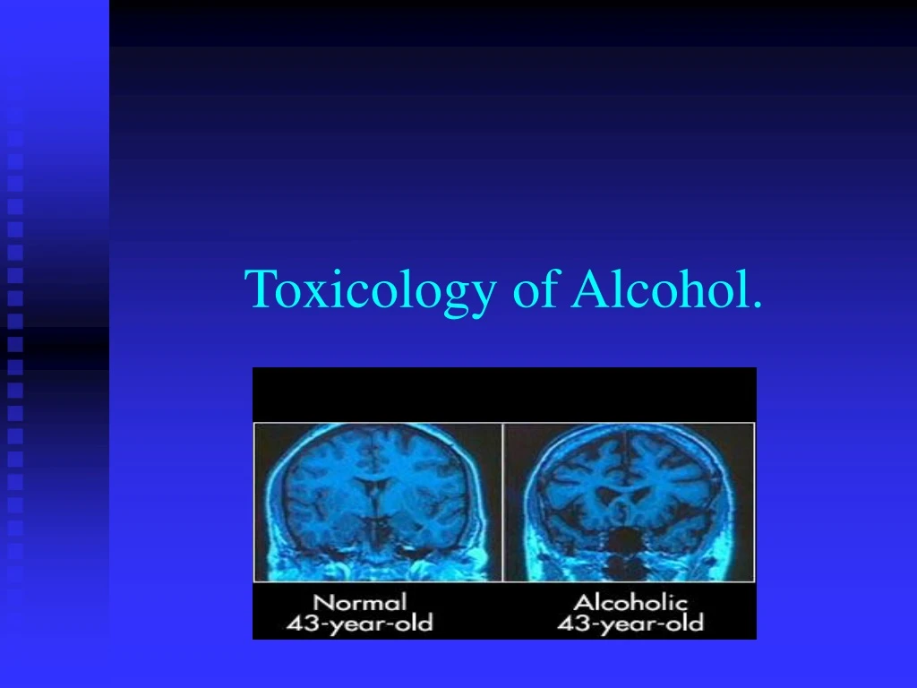 toxicology of alcohol