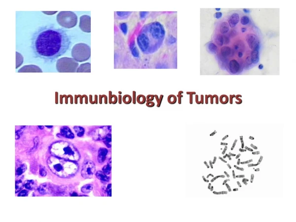 Immunbiology  of  Tumors