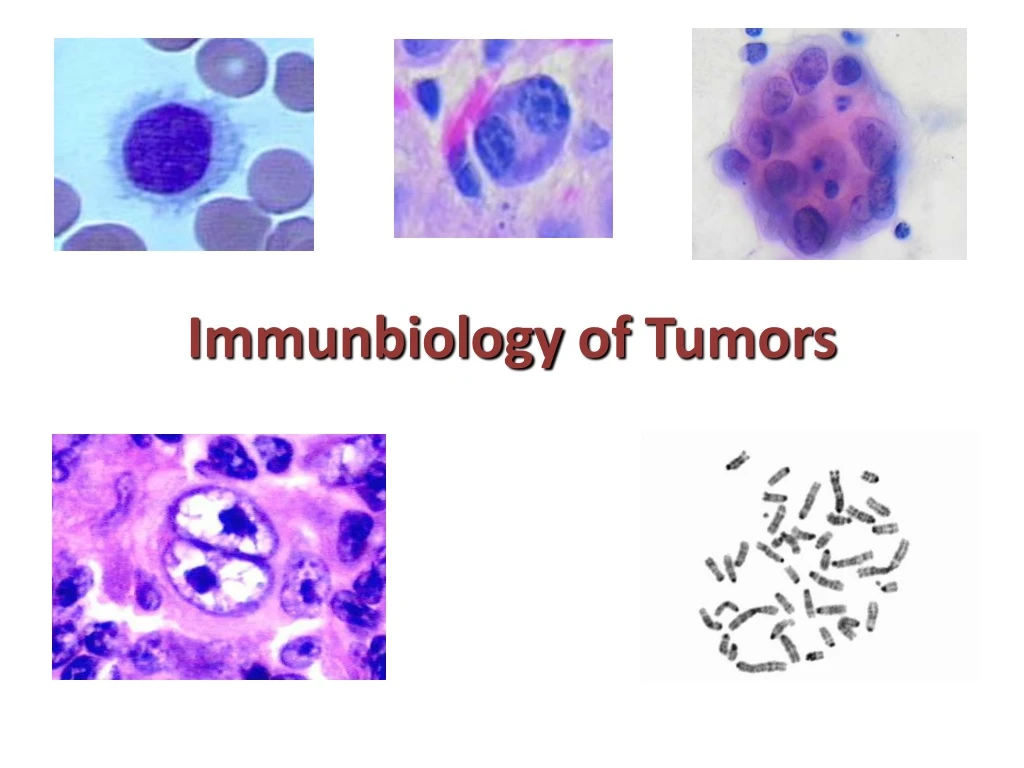 immunbiology of tumors