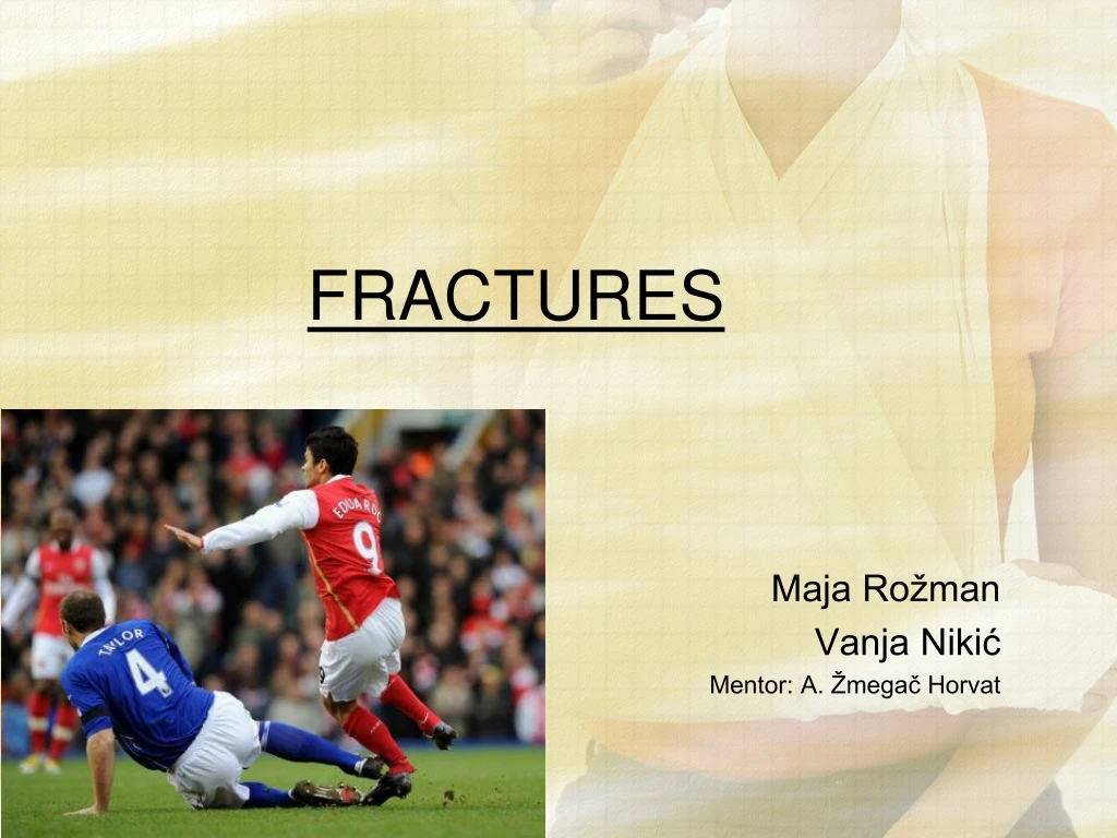 fractures