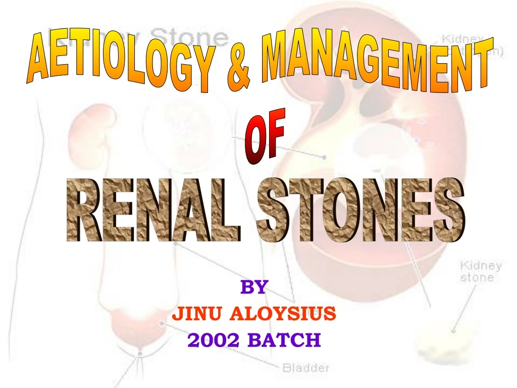 aetiology management of