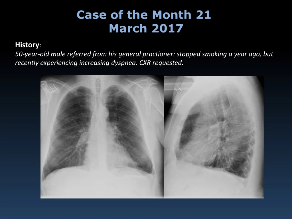 case of the month 21 march 2017