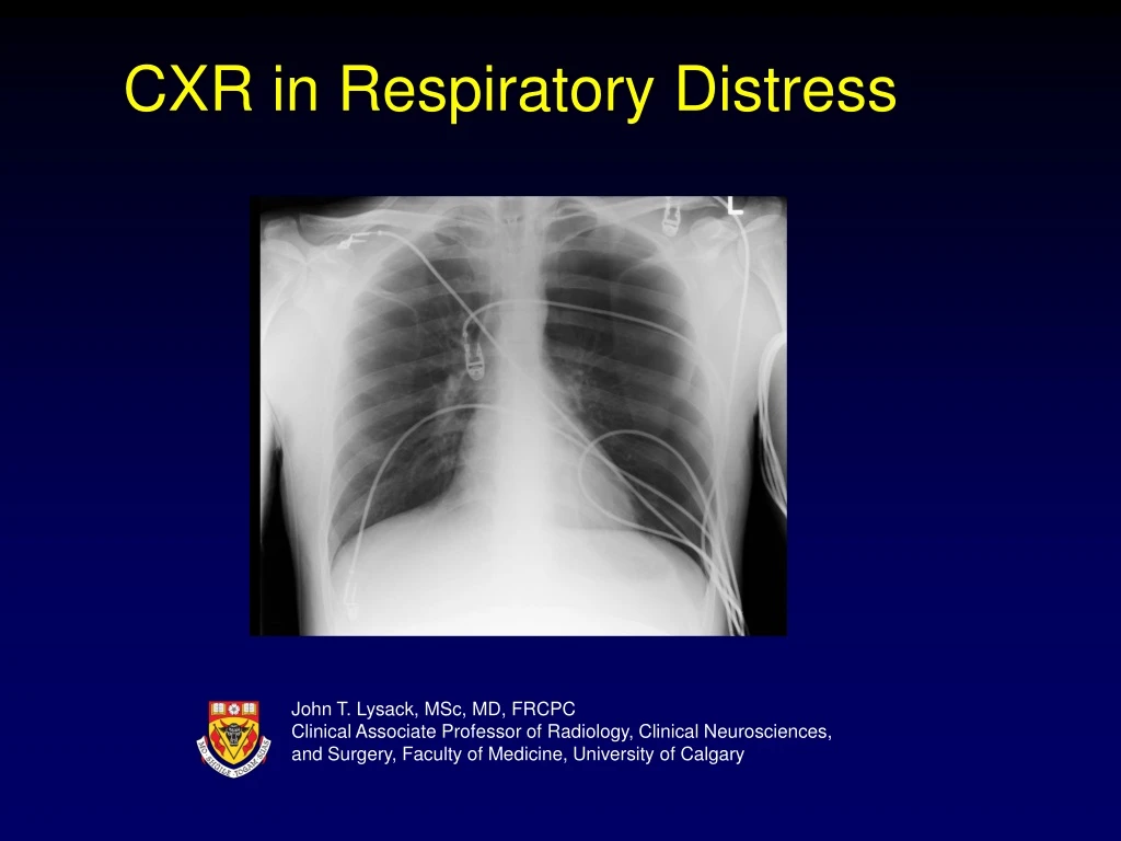 cxr in respiratory distress