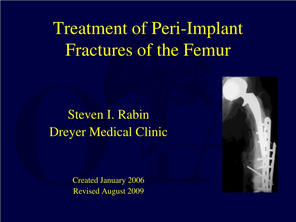 treatment of peri implant fractures of the femur