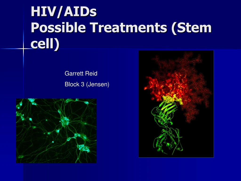 hiv aids possible treatments stem cell