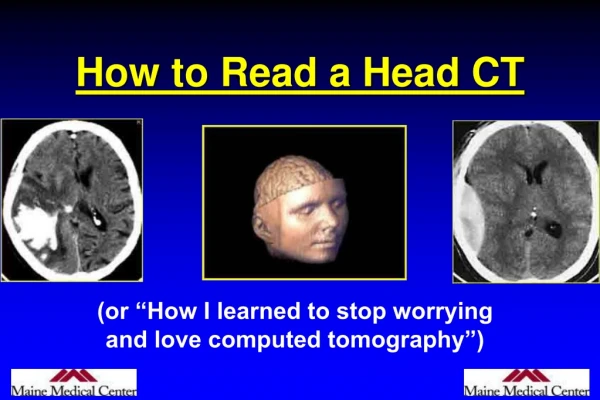 How to Read a Head CT