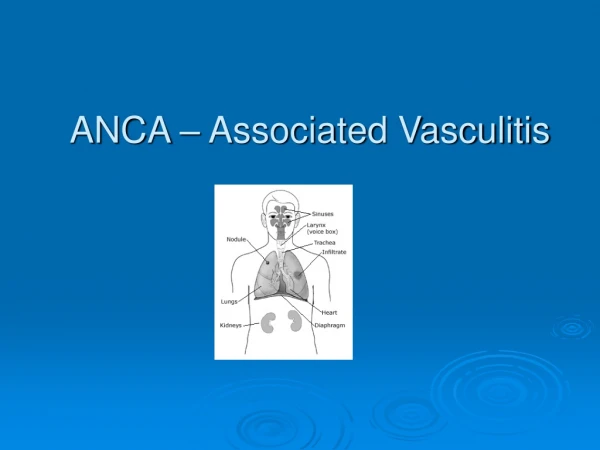 ANCA – Associated Vasculitis