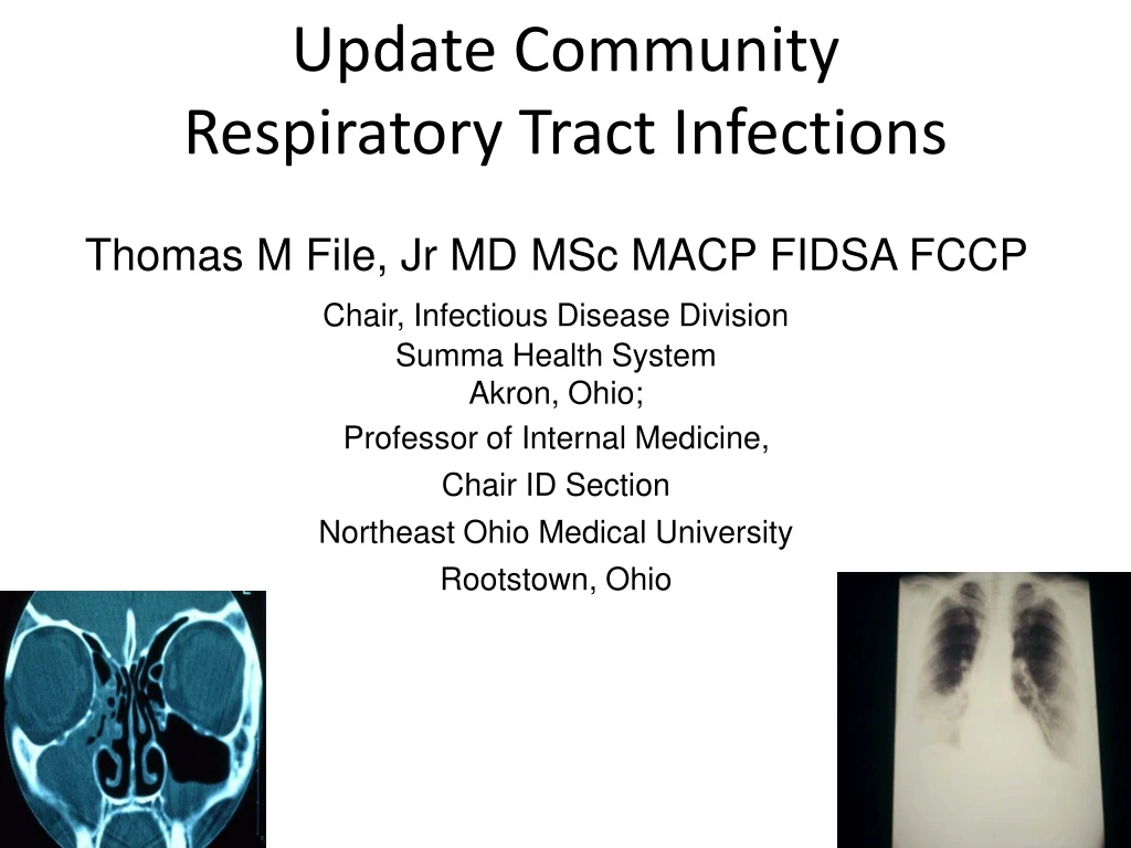 update community respiratory tract infections