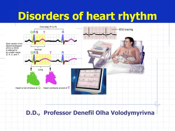 Disorders of heart rhythm