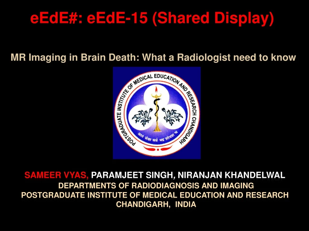 mr imaging in brain death what a radiologist need to know